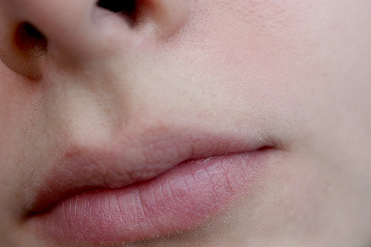 Shaving My Upper Lip | Experiment - Loepsie